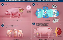 First human transplant of a genetically modified pig kidney performed