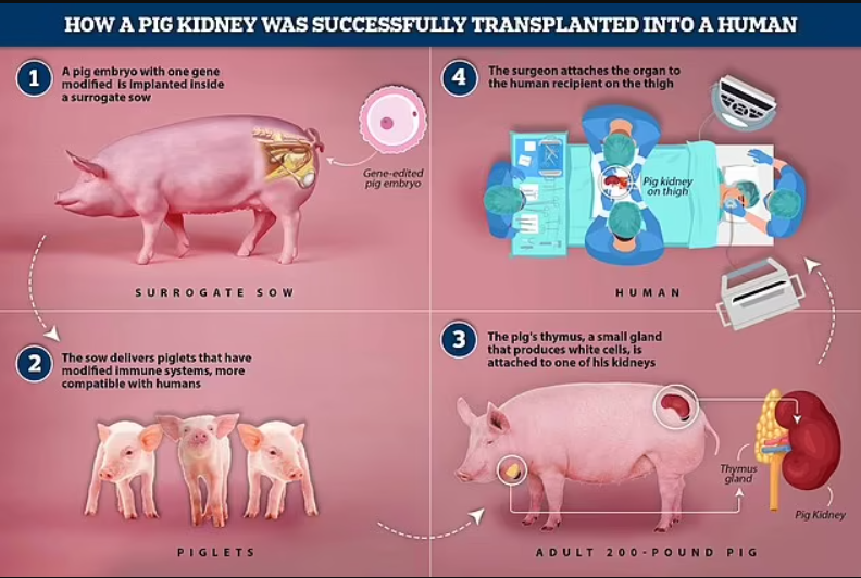 First human transplant of a genetically modified pig kidney performed